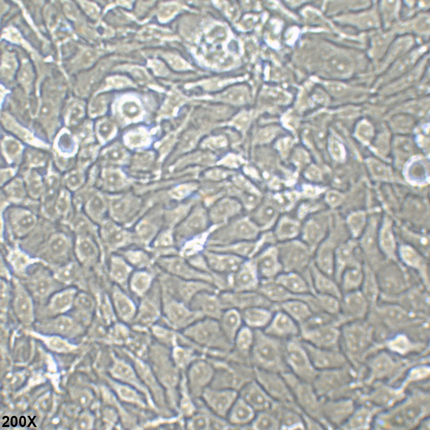 NCI-H1650 人肺支气管癌细胞