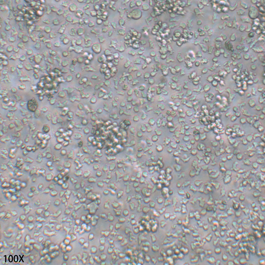 SHI-1 人急性髓细胞白血病细胞
