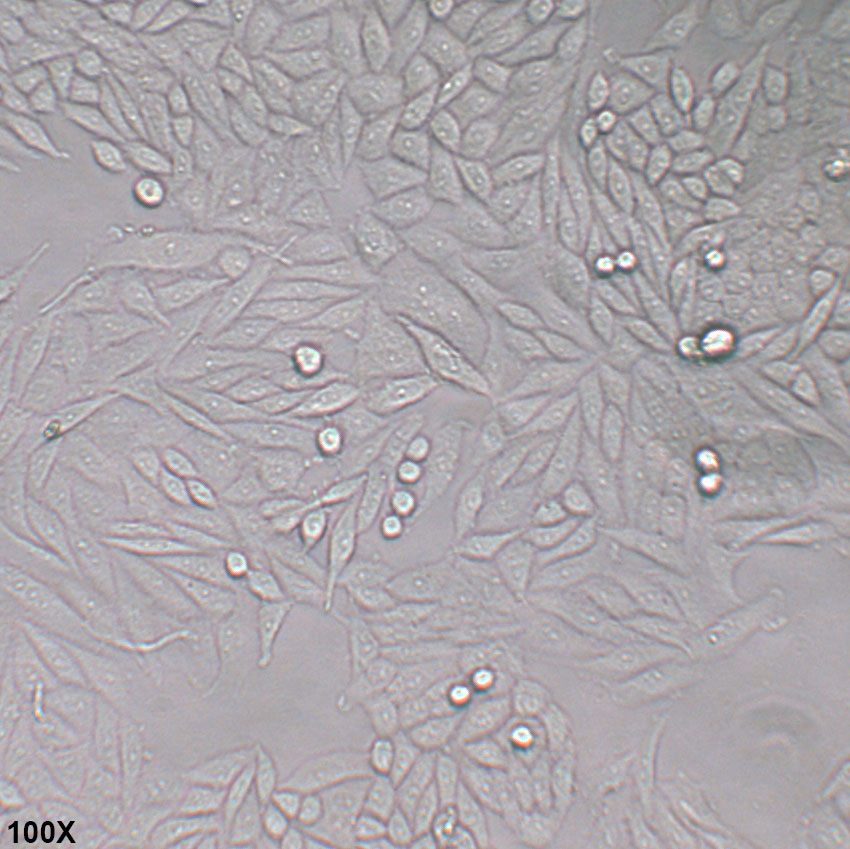 SiHa 人子宫颈鳞状细胞癌细胞