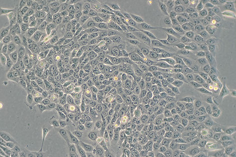 SAS 人舌鳞癌细胞