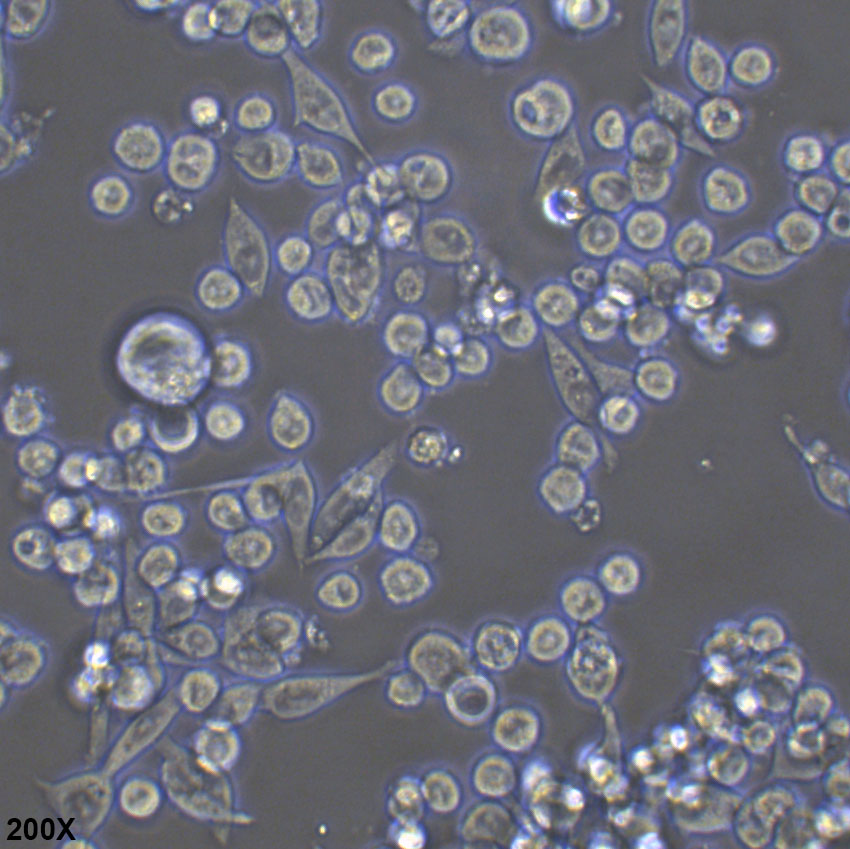 MKN45 人胃癌细胞