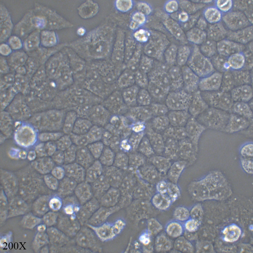 Hela 人宫颈癌细胞