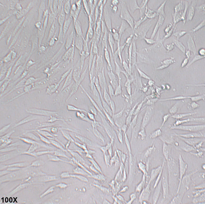 SW982 人滑膜肉瘤细胞