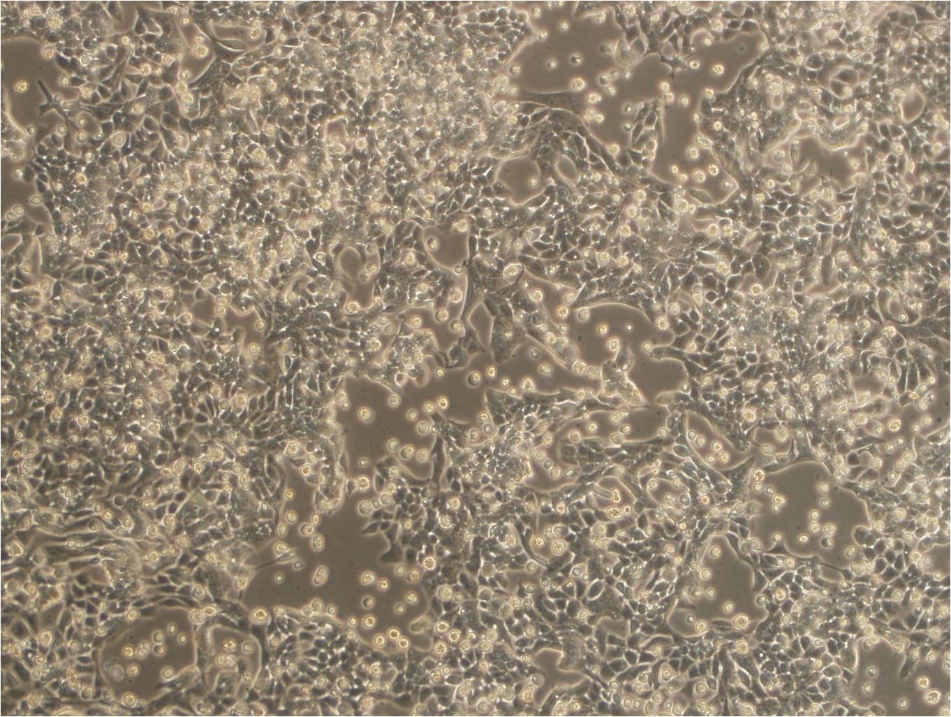 RL95-2 人子宫内膜癌细胞