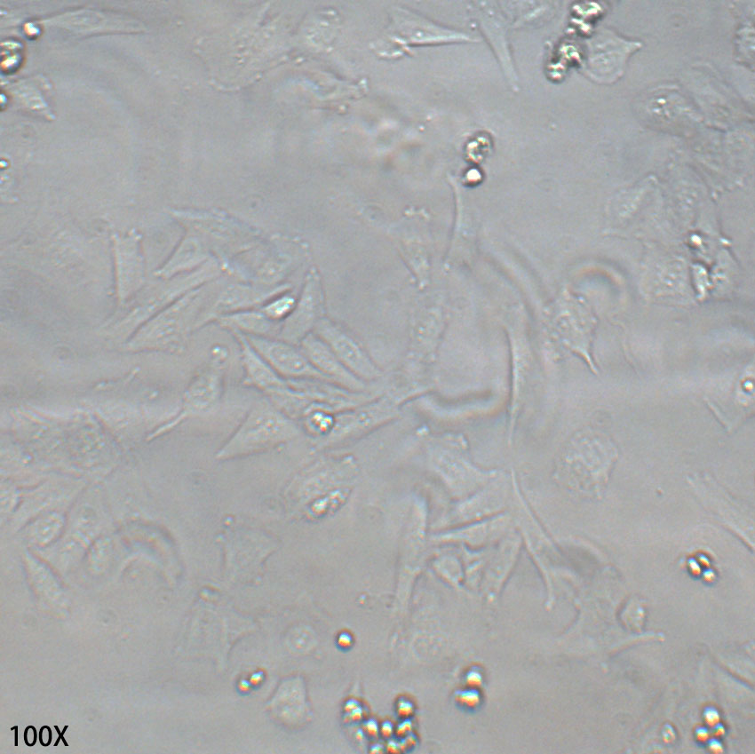 SAOS-2 人成骨肉瘤细胞