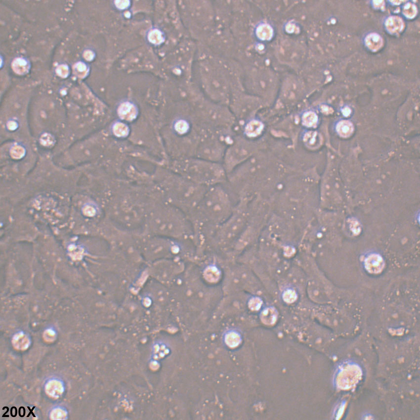 PA-1 人卵巢畸胎瘤细胞