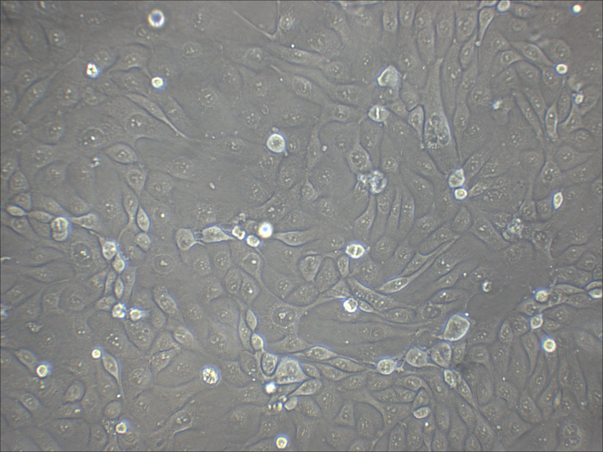SNU-216 人胃癌细胞（淋巴转移）