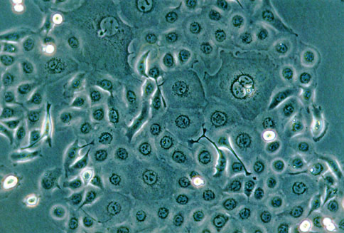 TE-1 人食管癌细胞