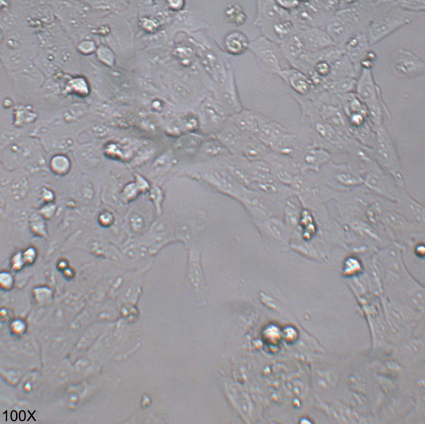 KMH-2 人甲状腺癌细胞（退行性）
