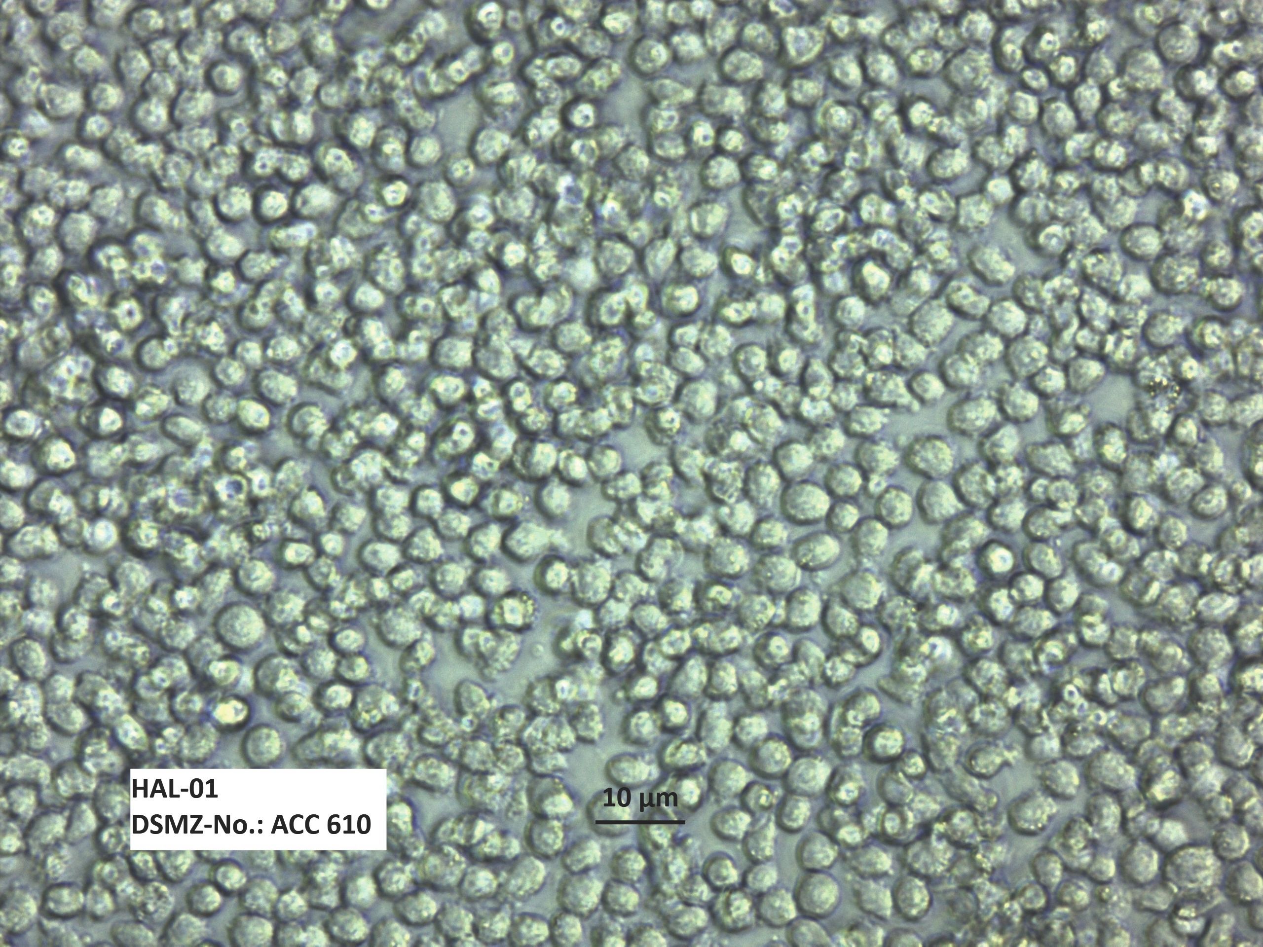 HAL-01 人急性淋巴细胞白血病细胞