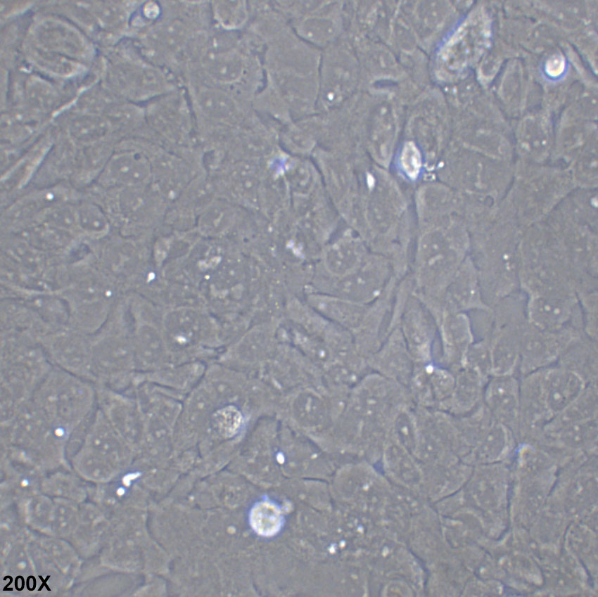 HCC38 人乳腺导管癌细胞