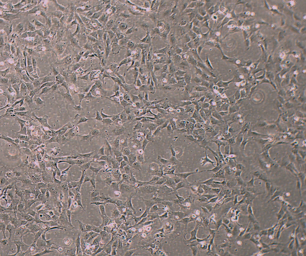HUVEC-T1 人脐静脉内皮细胞