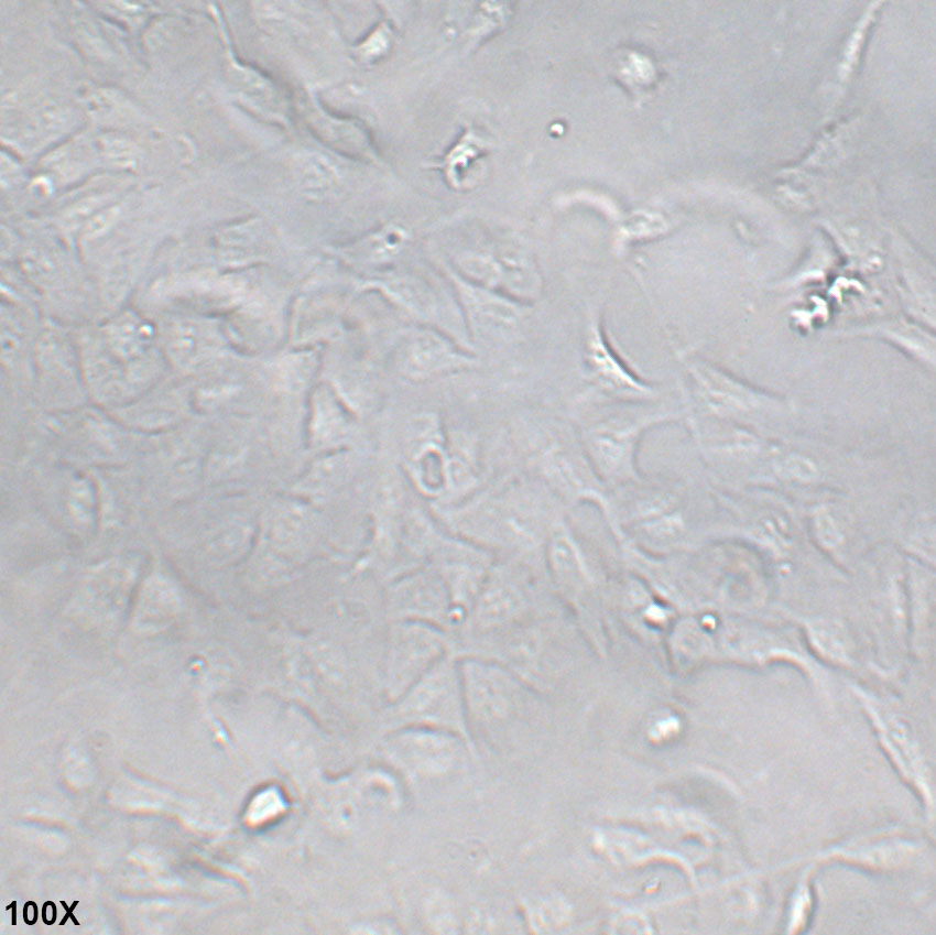RBE 人胆管细胞型肝癌细胞