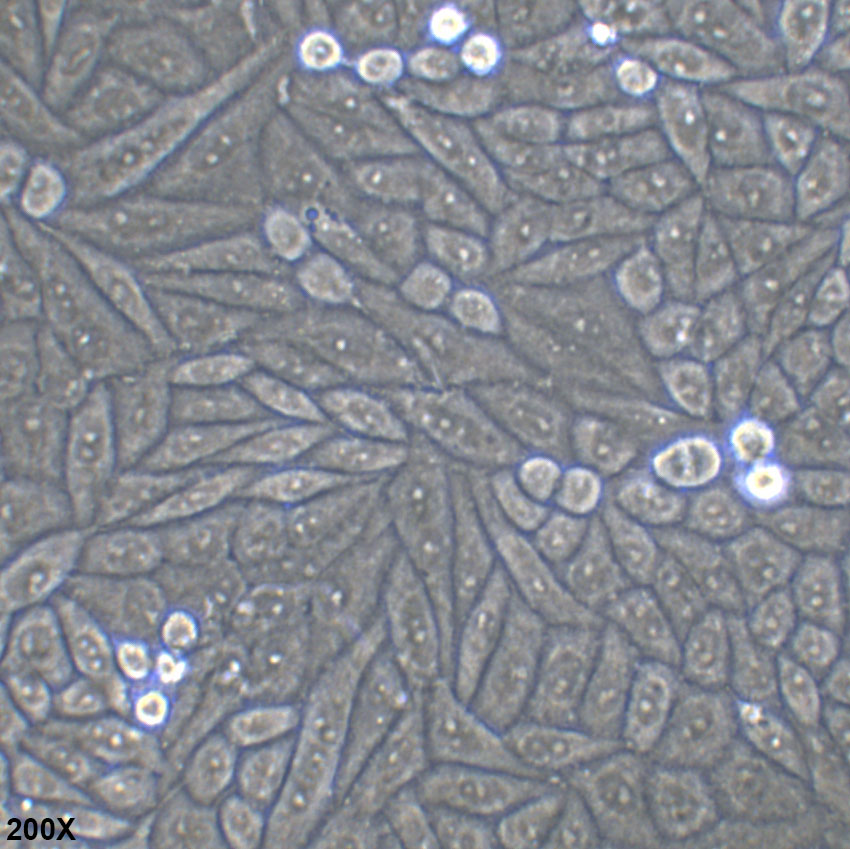 SiHa 人子宫颈鳞状细胞癌细胞