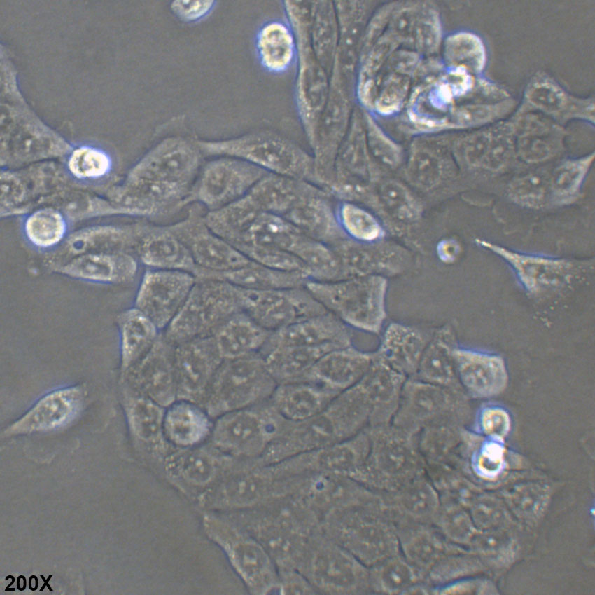 CFPAC-1 人胰腺癌细胞