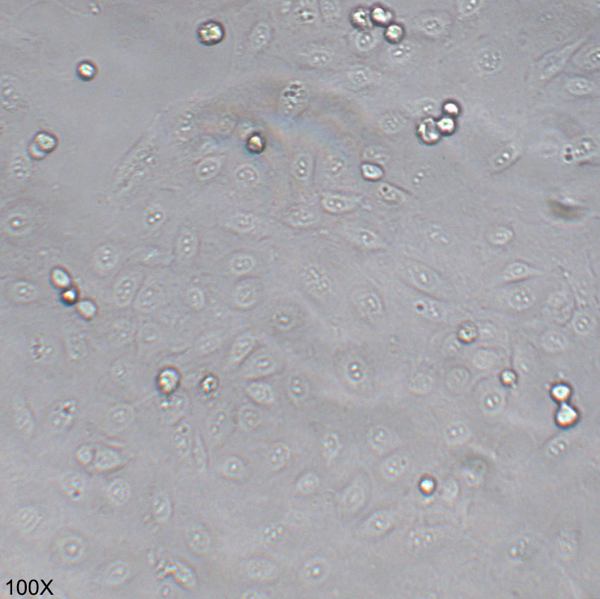 SNU-182 人肝癌细胞