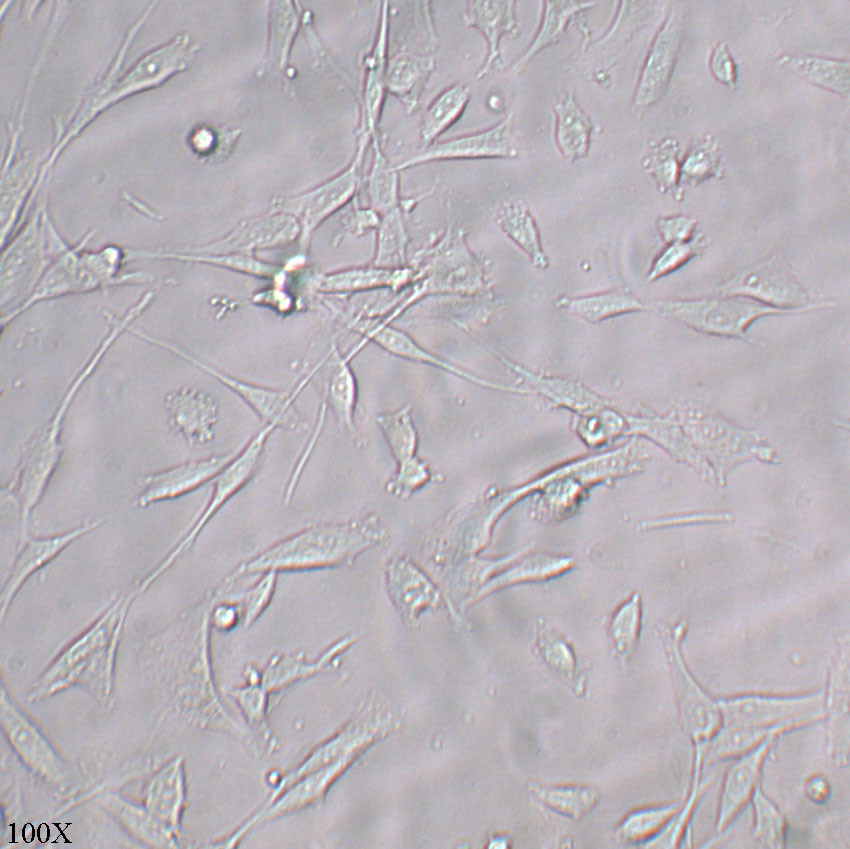 U-118 MG 人脑星形胶质母细胞瘤细胞