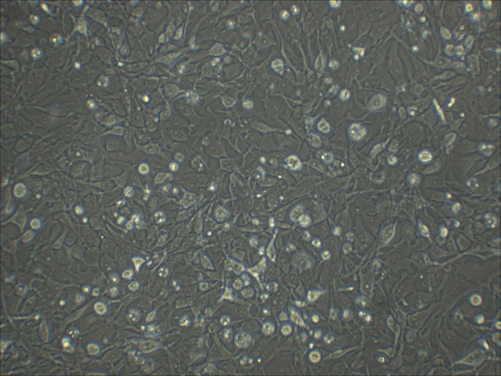 Kyse-410 人食管鳞癌细胞