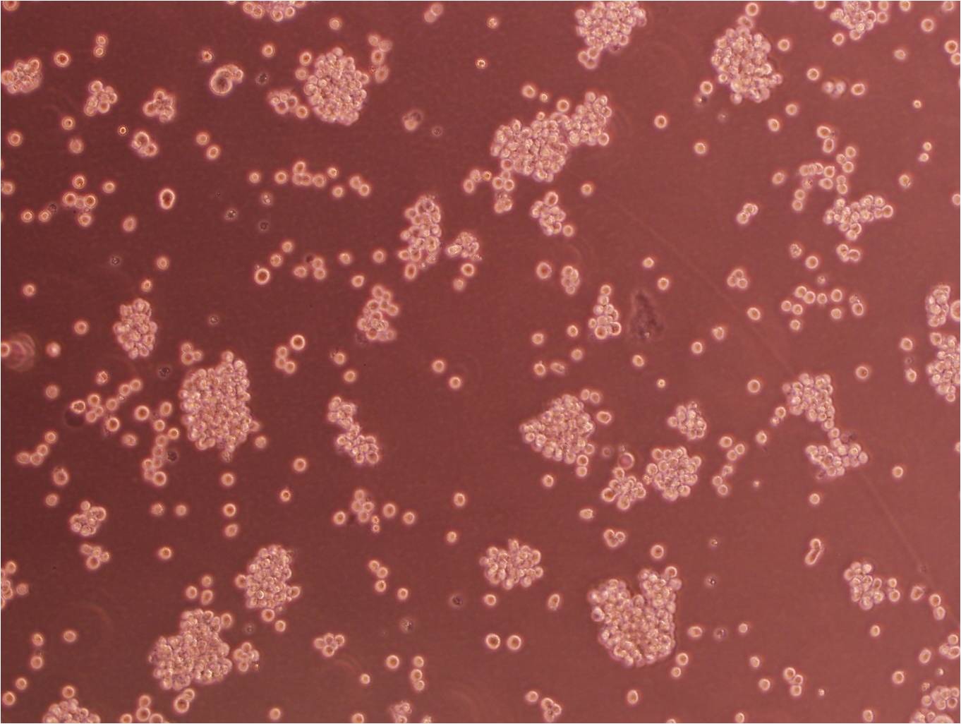 Raji 黑人Burkitt淋巴瘤细胞