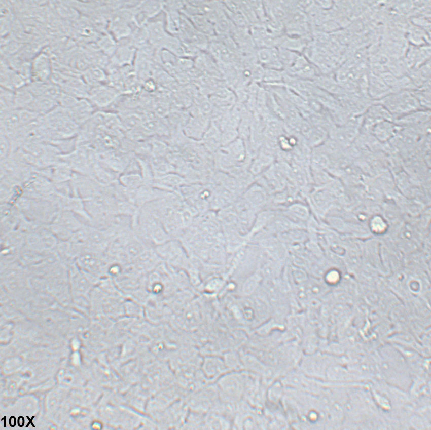 HCC38 人乳腺导管癌细胞