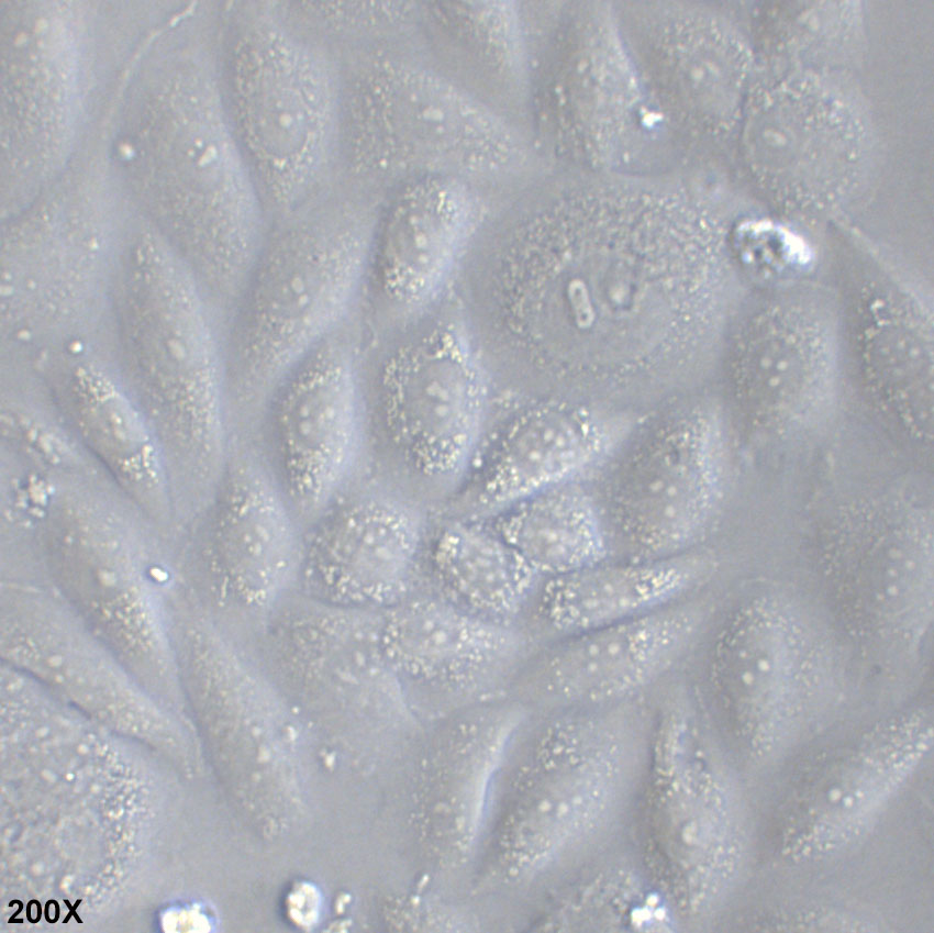 SK-Lu-1 人低分化肺腺癌细胞