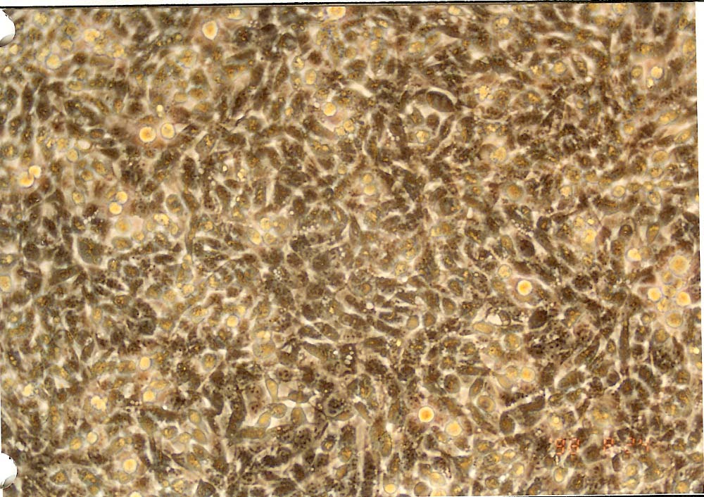 BNL 1ME A.7R.1 小鼠肝瘤细胞