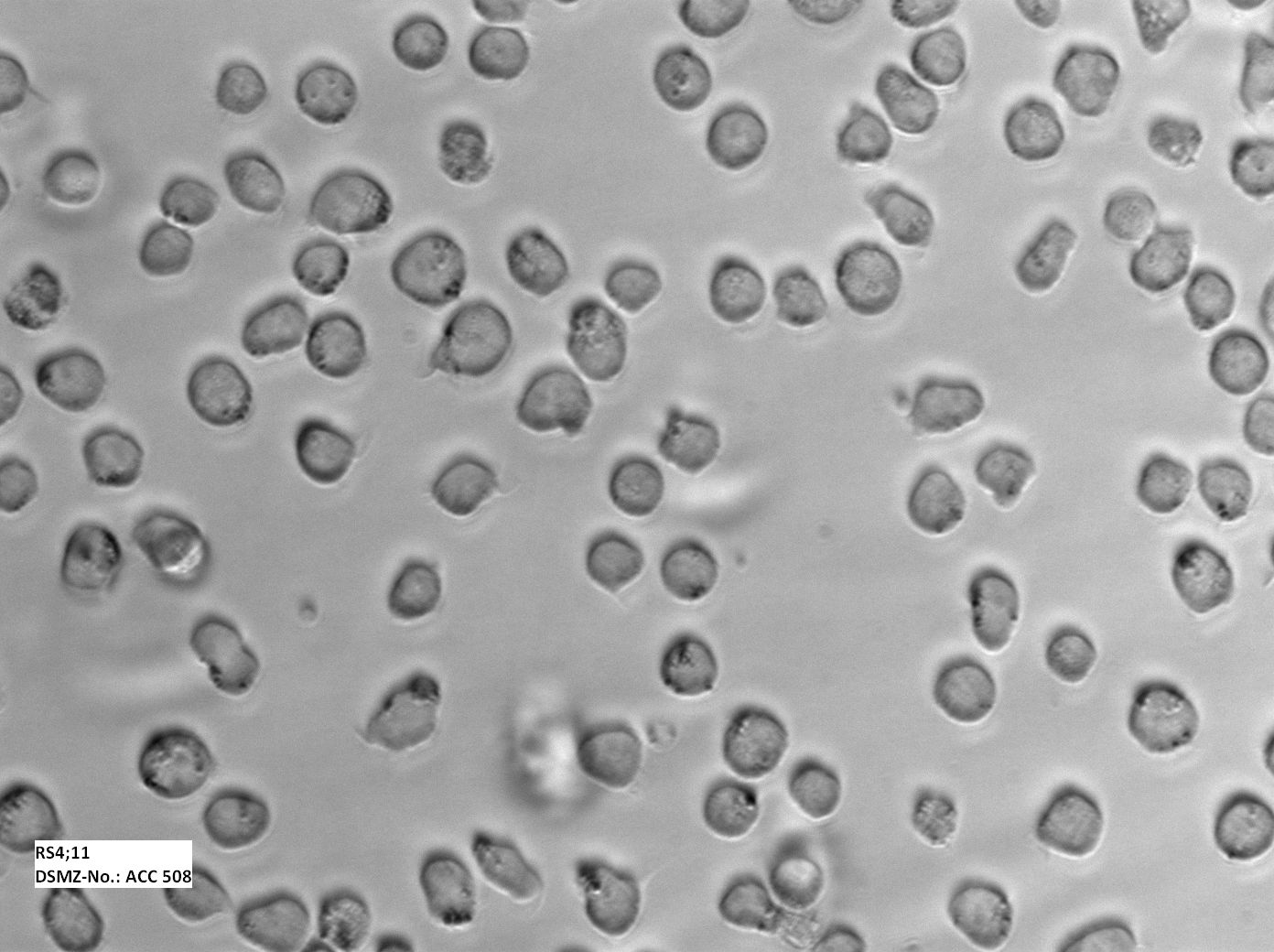 RS4;11 人急性淋巴白血病细胞
