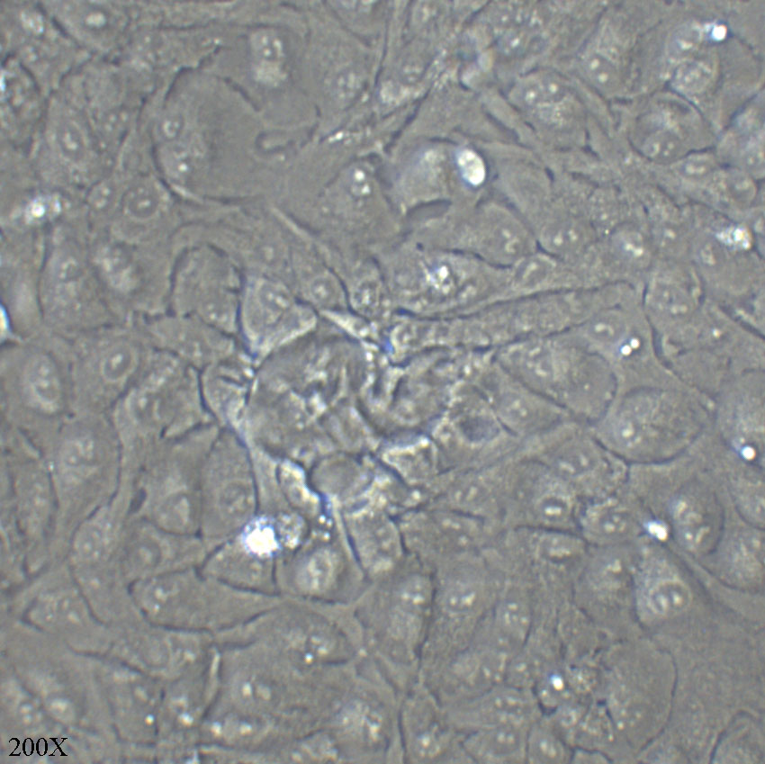 ARPE-19 人视网膜上皮细胞