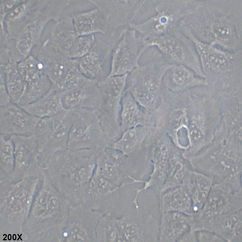RBE 人胆管细胞型肝癌细胞