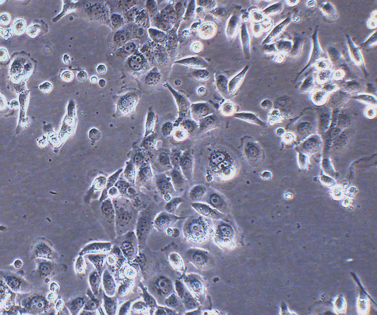 JIMT-1 人乳腺癌细胞