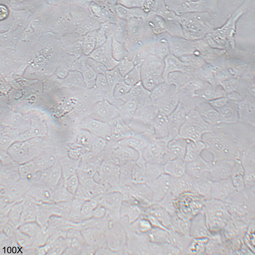 HCC4006 人肺癌腺癌细胞