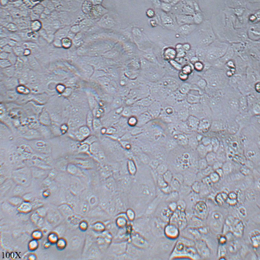 NIH/OVCAR-3 人卵巢腺癌细胞