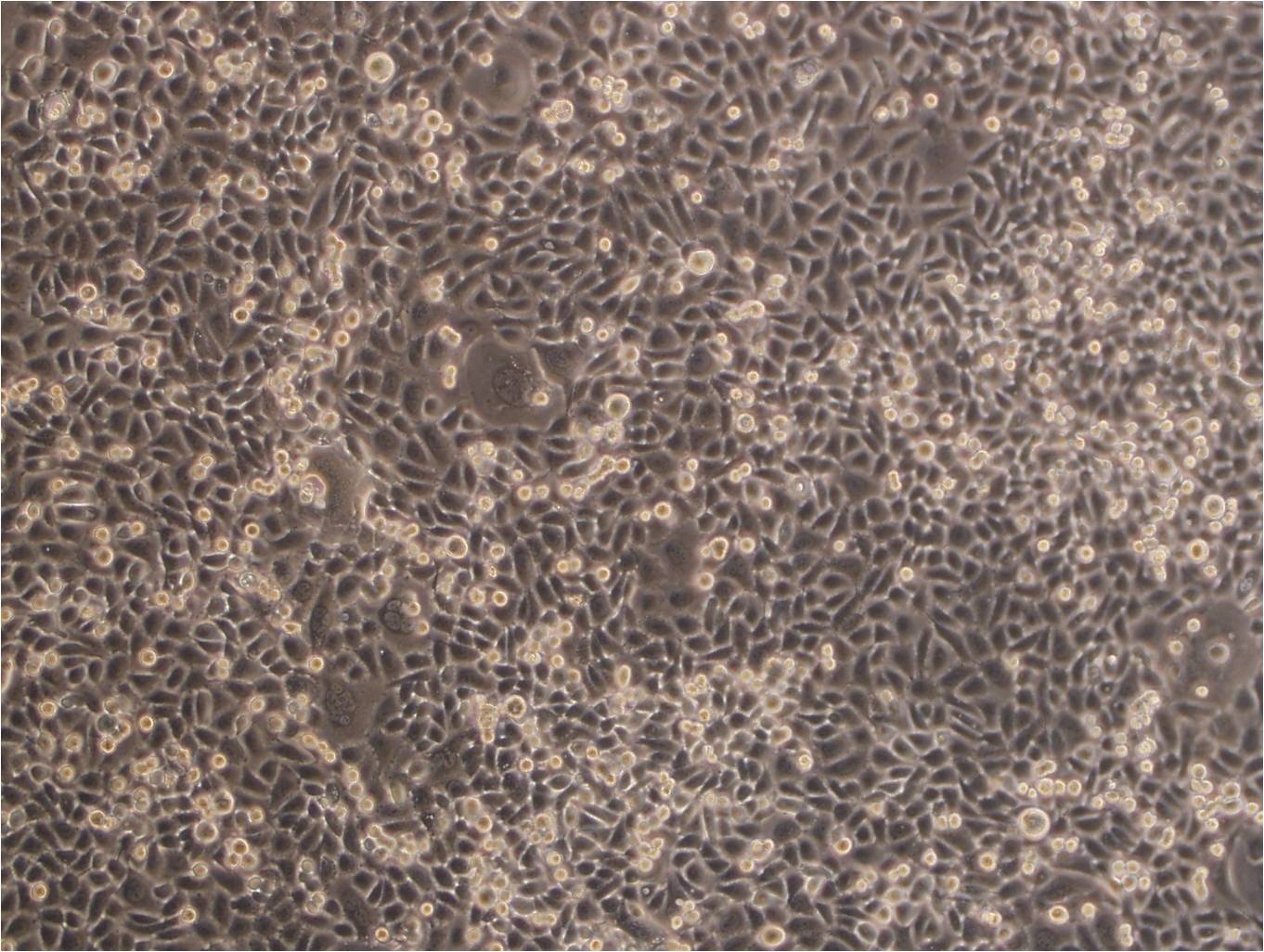 ME-180 人子宫颈表皮癌细胞