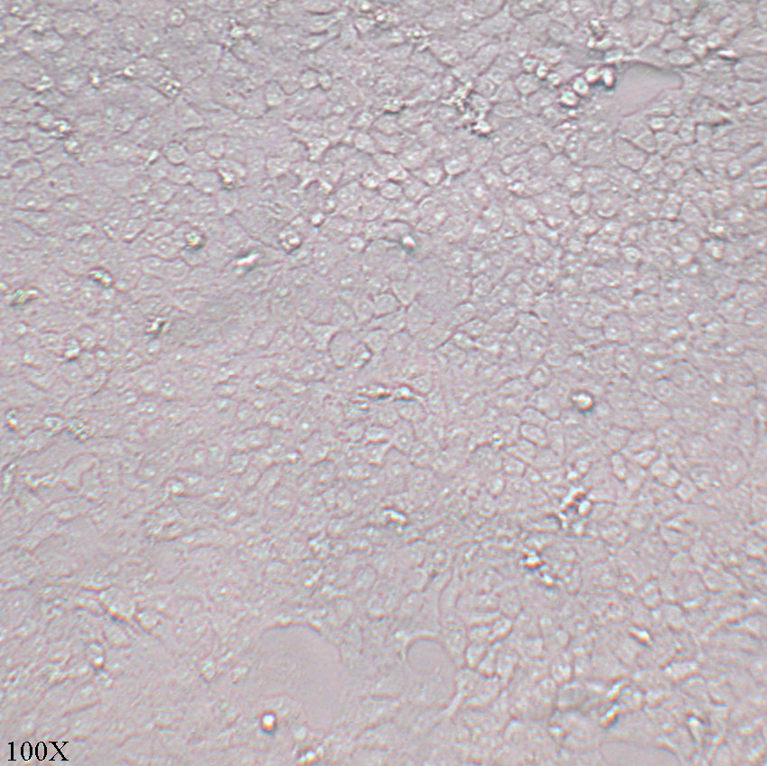 Cal-27 人舌鳞癌细胞