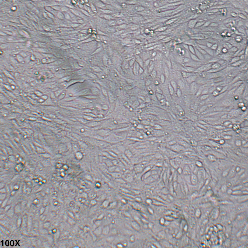 SV40 MES 13 小鼠肾小球系膜细胞