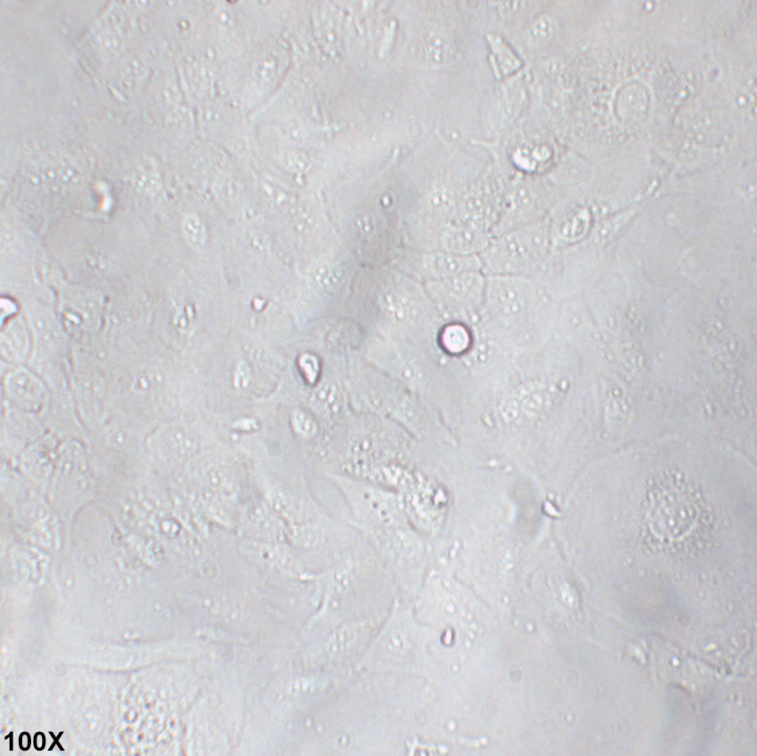 SCC-9 人舌鳞癌细胞