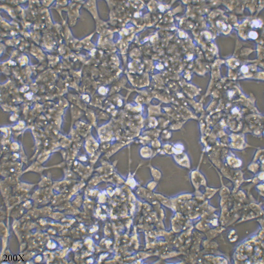 IMR-32 人神经母细胞瘤细胞