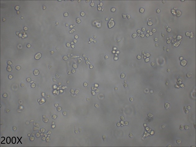 KARPAS-422 人B细胞淋巴瘤细胞