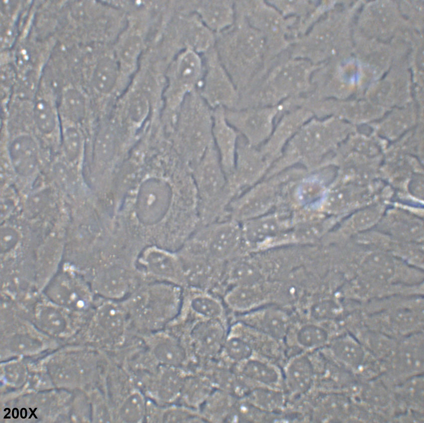 H4 人脑神经胶质瘤细胞