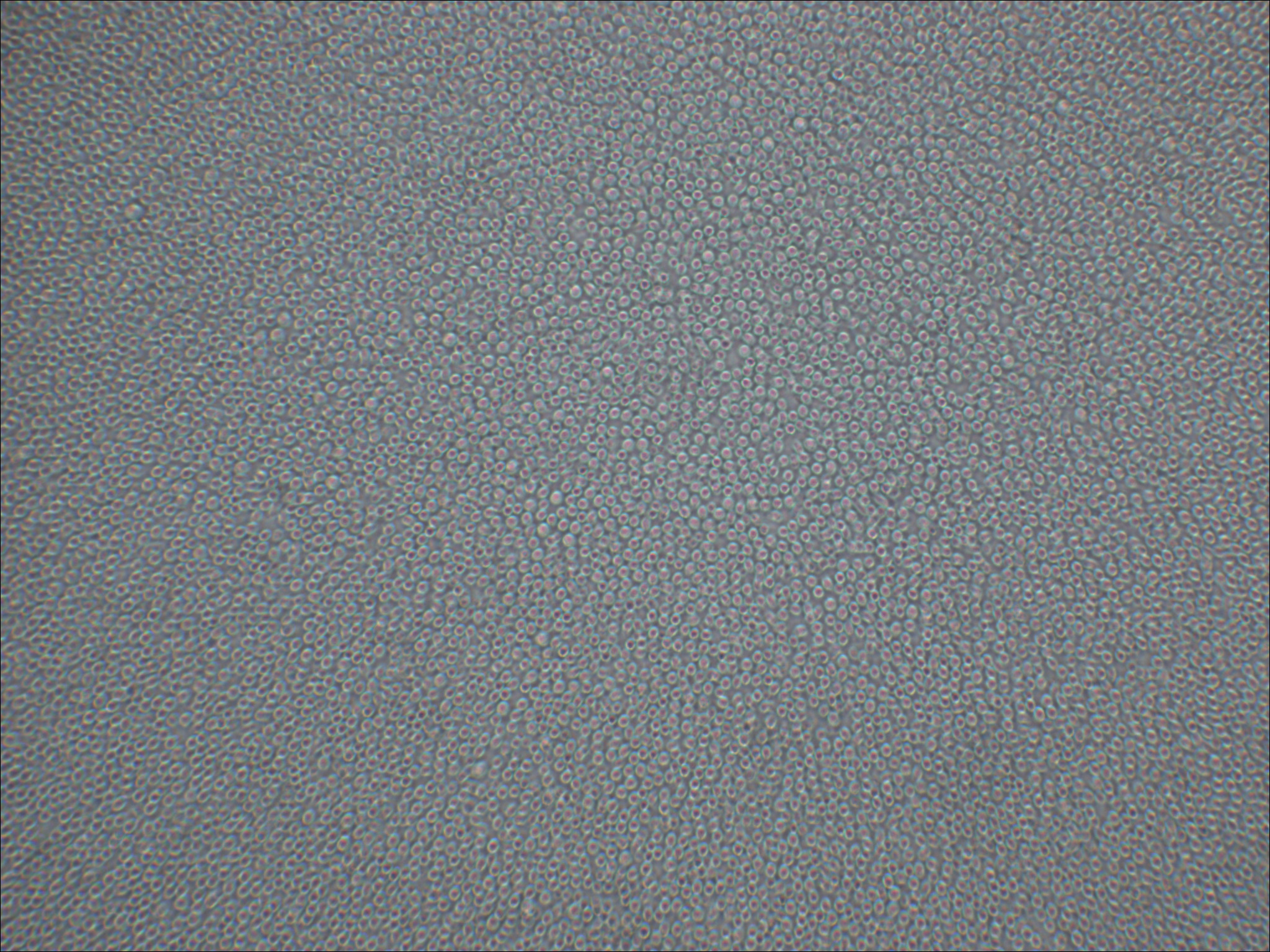 NALM6 B系急性淋巴细胞白血病细胞