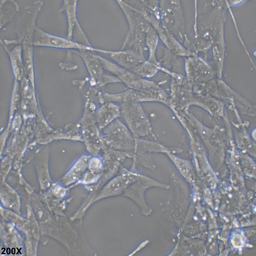 MOG-G-UVW 人脑星形胶质细胞瘤细胞