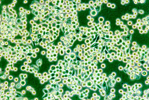 KATO III 人胃癌细胞