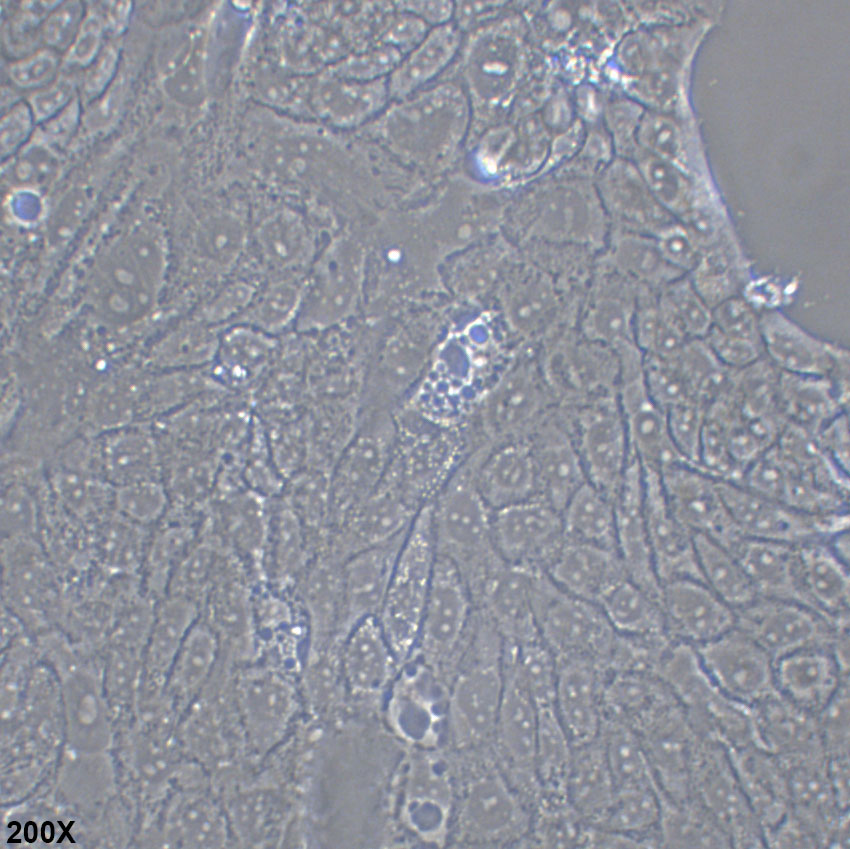 SW1116 人结肠腺癌细胞