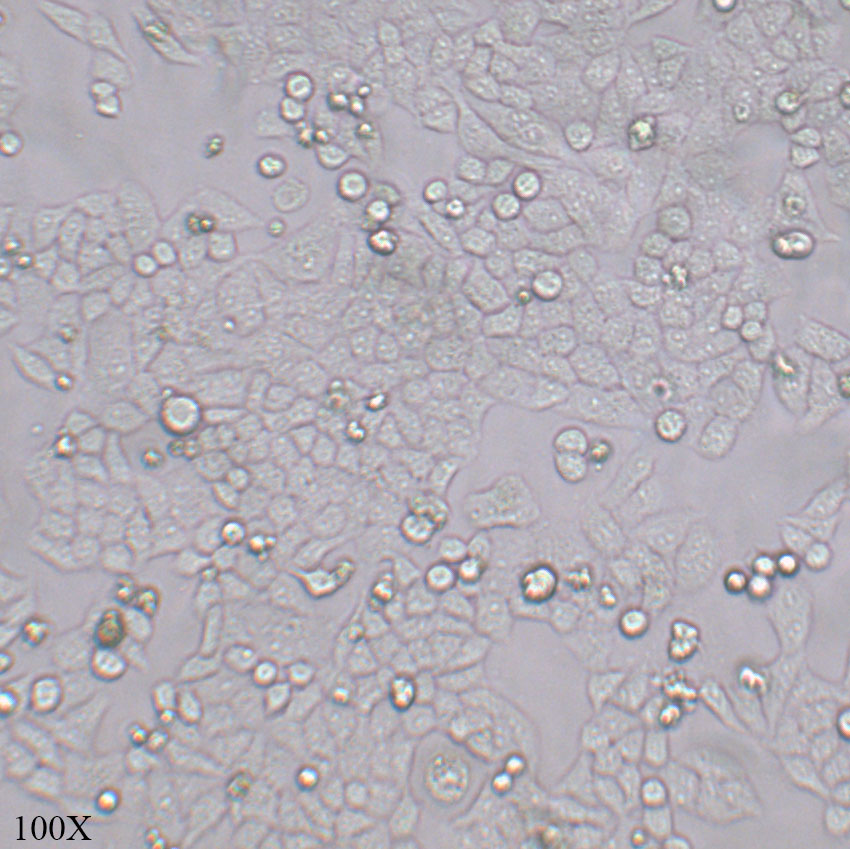 Hela 人宫颈癌细胞