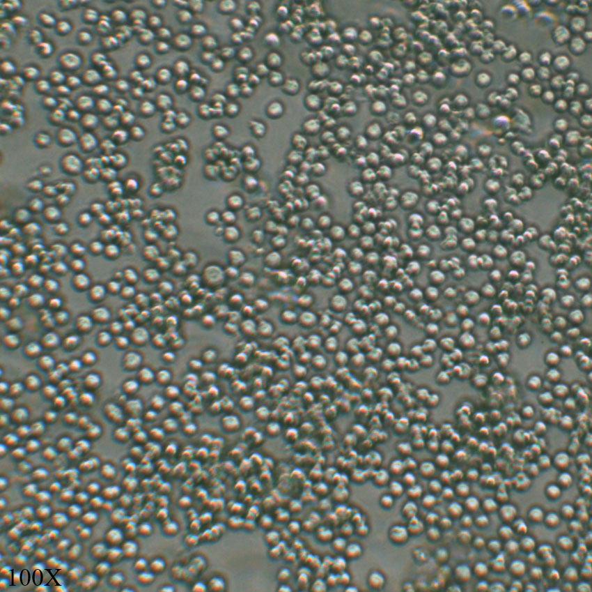 K562 人慢性髓原白血病细胞
