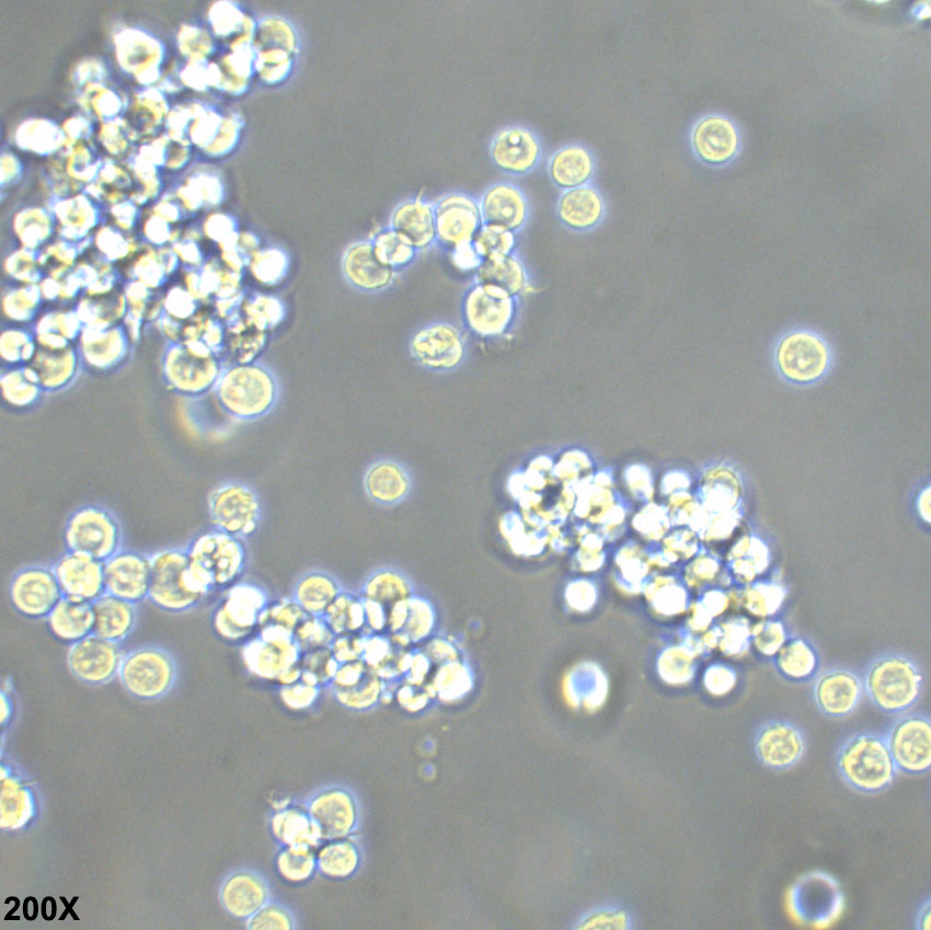 HEL 人红白细胞白血病细胞