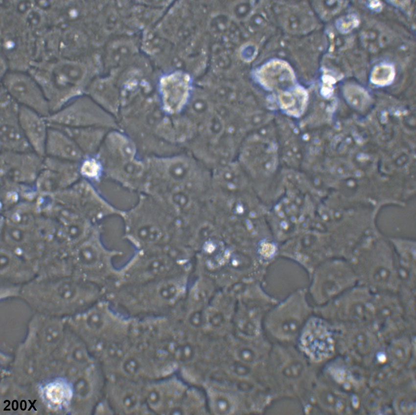 NCI-H1395 人肺腺癌细胞