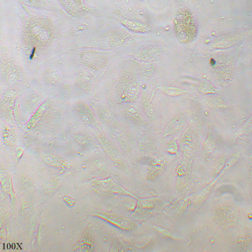 A498 人肾癌细胞