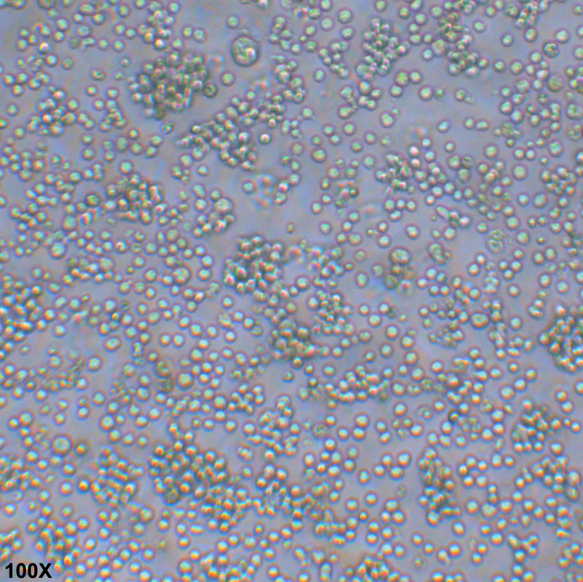 Daudi 人Burkkit淋巴瘤细胞