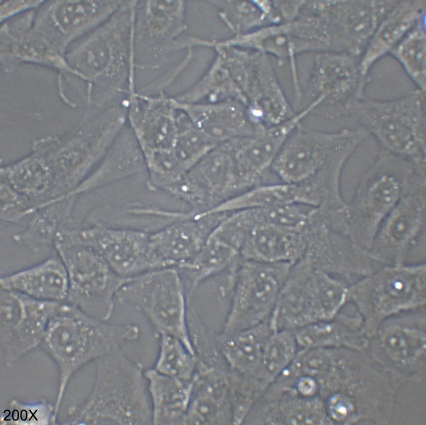 KHM-5M 人甲状腺癌细胞（退行性）